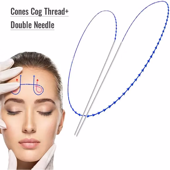 Best Effect Cog Lifting Nose Thread Kits Face Lift Pcl Pdo